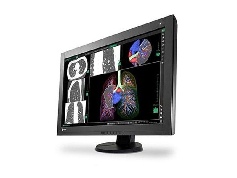 EIZO RadiForce RX440 29.8型液晶モニ　WQXGA Eizo RadiForce RX440-BK / RX440BK 4MP Radiology Monitor | Ampronix