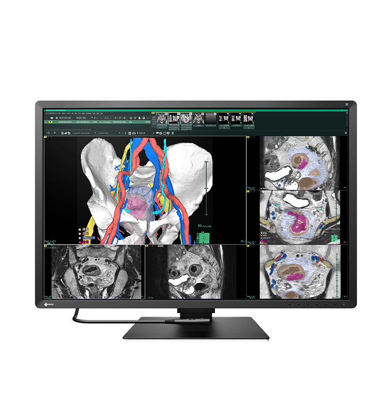 Eizo RadiForce RX670-BK 30 inch 6MP color diagnostic radiology monitor