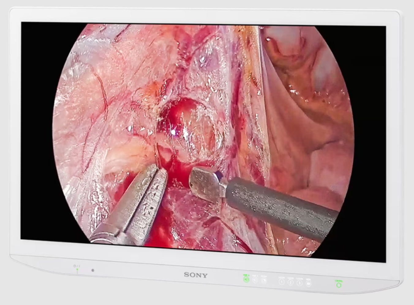 Sony LMD-27M1MD 27" 4K UHD 2D Surgical Monitor