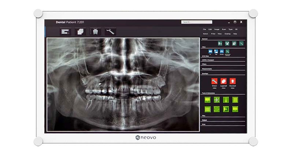 AG Neovo DR-2202 22" Dental LCD Monitor