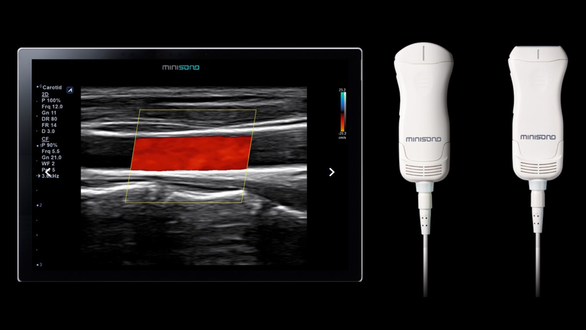 Alpinion minisono Tablet Ultrasound | Sales & Replacement