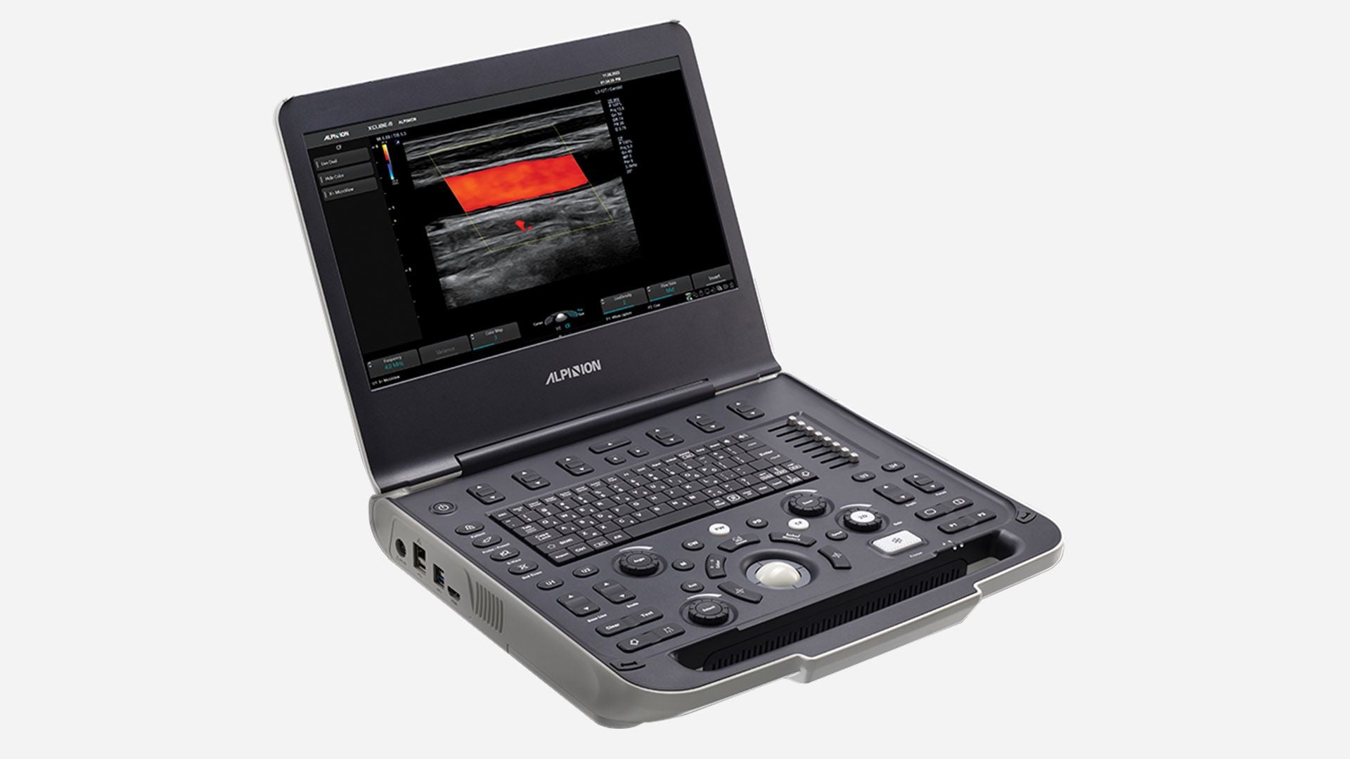 Alpinion X-CUBE i8 / XCUBE i8 Portable Ultrasound System – Sales, Replacement ^& Exchange