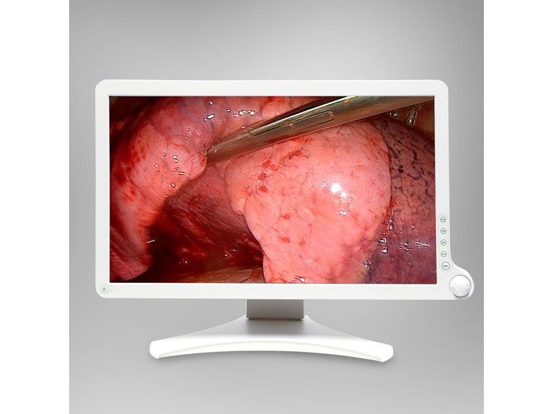 Barco AMM215WTD 21.5" FHD Surgical LCD Monitor