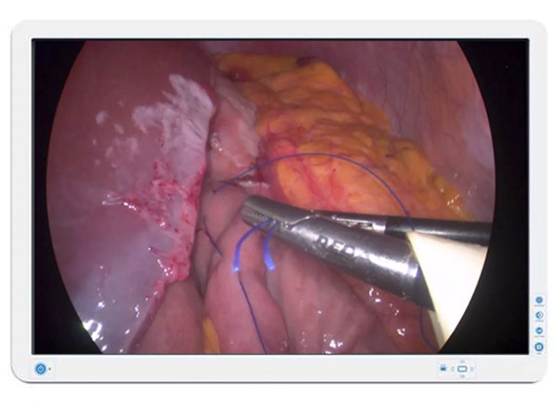 Barco AMM240ED 24" WUXGA Surgical LCD Monitor