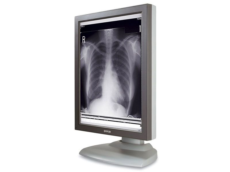 BARCO MFGD-3420 3MP Diagnostic Monitor