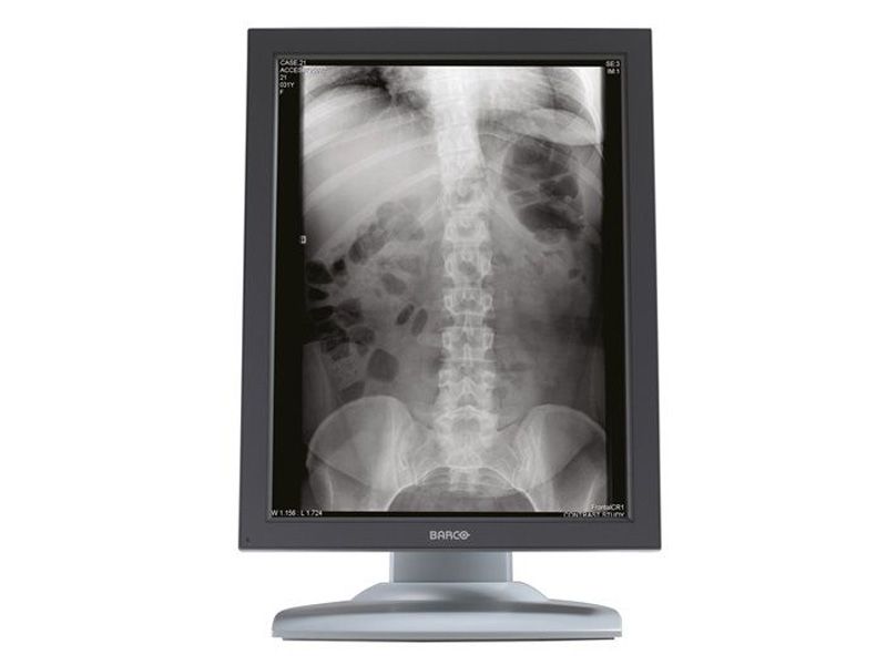 Barco E-3620 MA 3MP Diagnostic Radiology Monitor