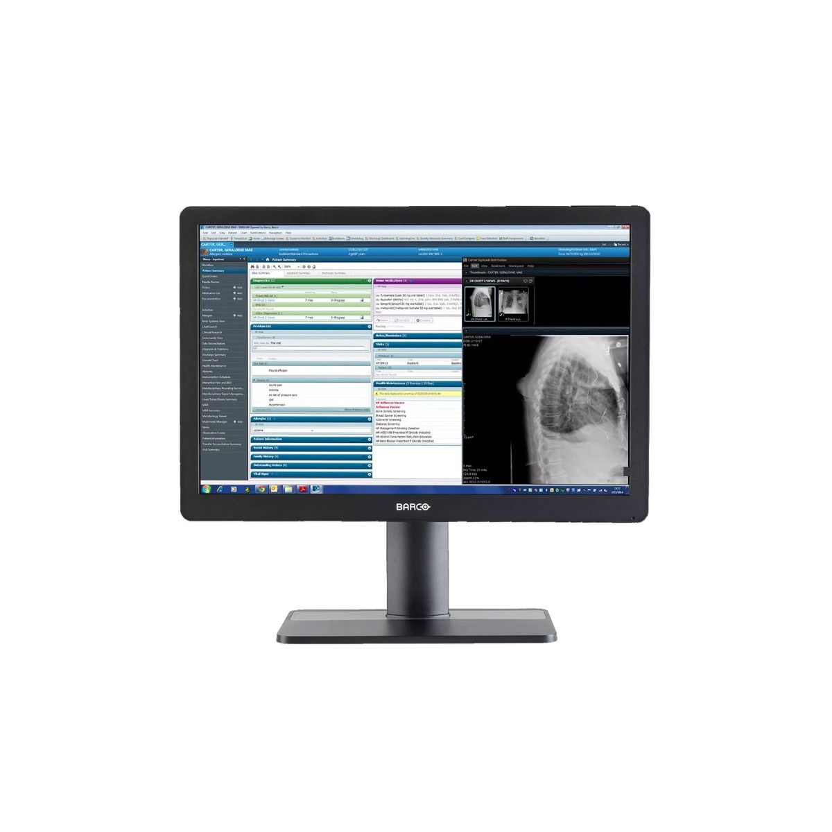 Barco MDRC-2324 24" Clinical Review Display Monitor