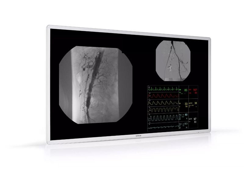 Barco MDAC-8355 55" 4K UHD Surgical LCD Monitor