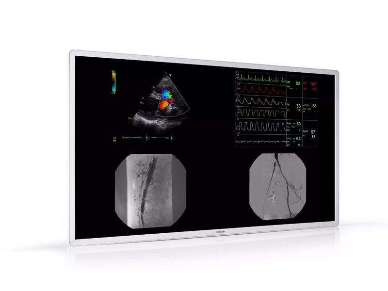 Barco MDAC-8355 55" 4K UHD Surgical LCD Monitor