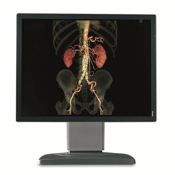 Barco MDCC-2121 2MP Diagnostic Monitor