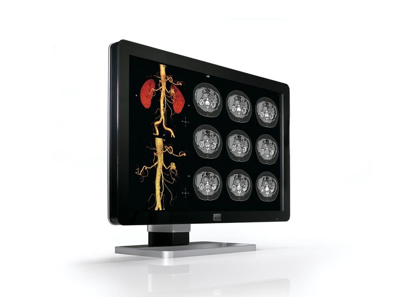 Barco Coronis MDCC-4130 4MP Diagnostic Radiology Monitor