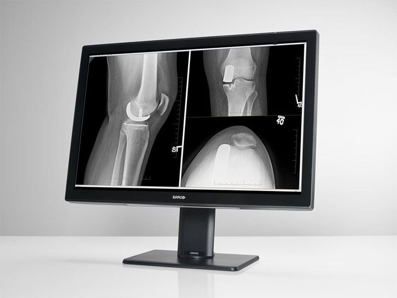 Barco MDCC-4430 4MP Diagnostic Radiology Monitor