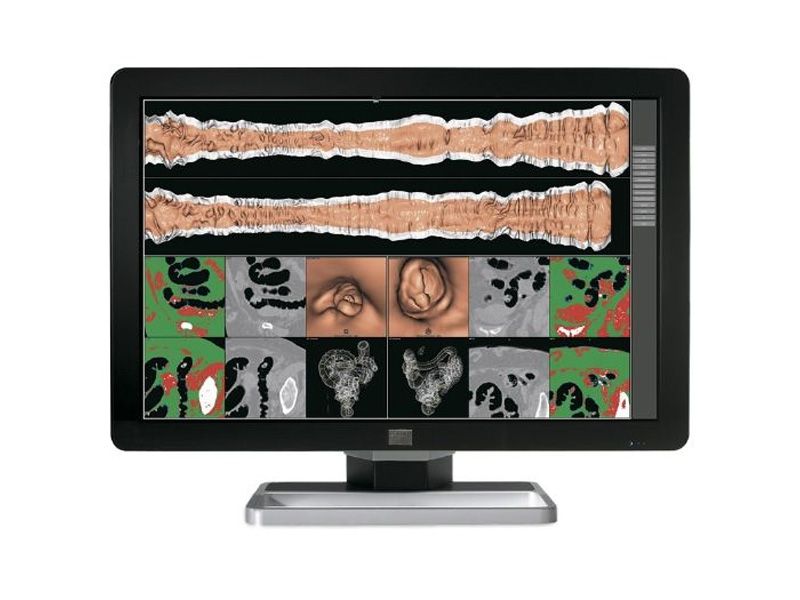 Barco MDCC-6130 6MP Diagnostic Radiology Monitor