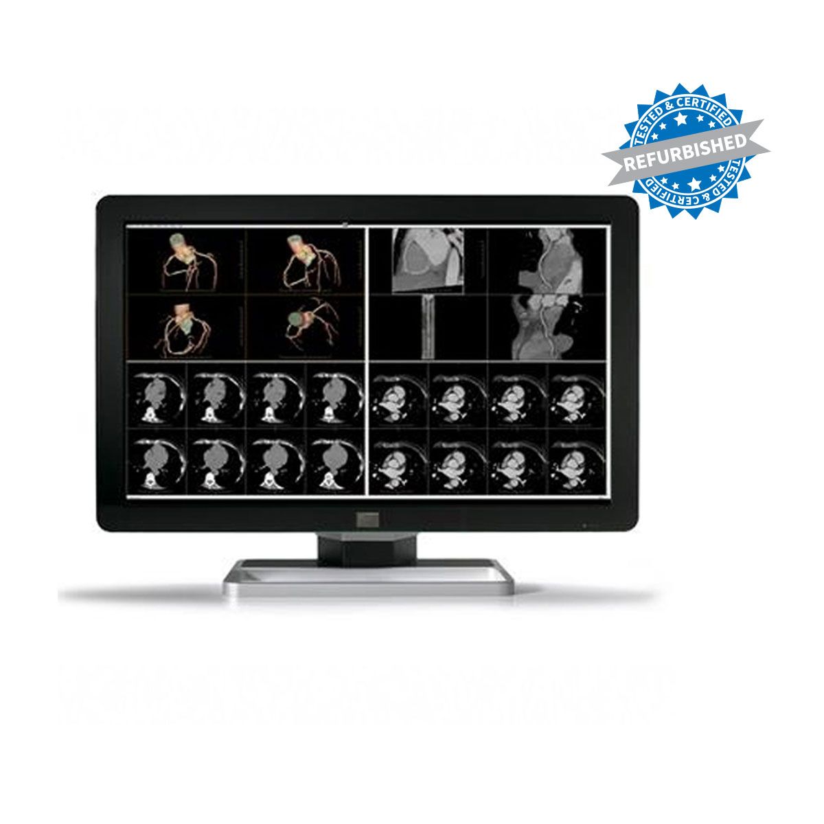 Barco Coronis MDCC-6230 6MP Diagnostic Radiology Monitor