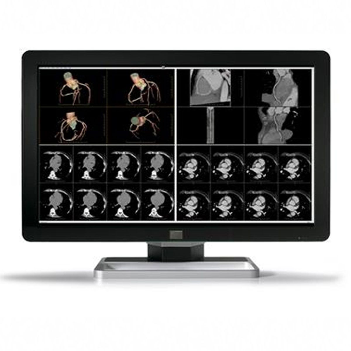 Barco Coronis MDCC-6230 6MP Diagnostic Radiology Monitor