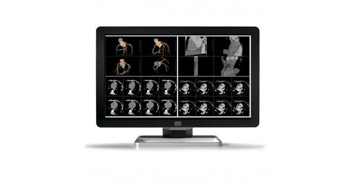 Barco Coronis MDCC-6230 6MP Diagnostic Radiology Monitor