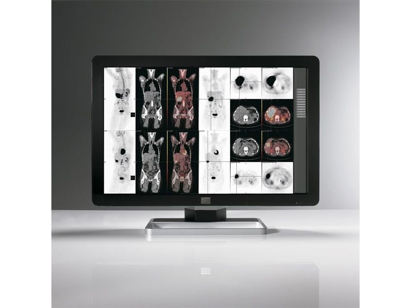 Barco Coronis MDCC-6230 6MP Diagnostic Radiology Monitor