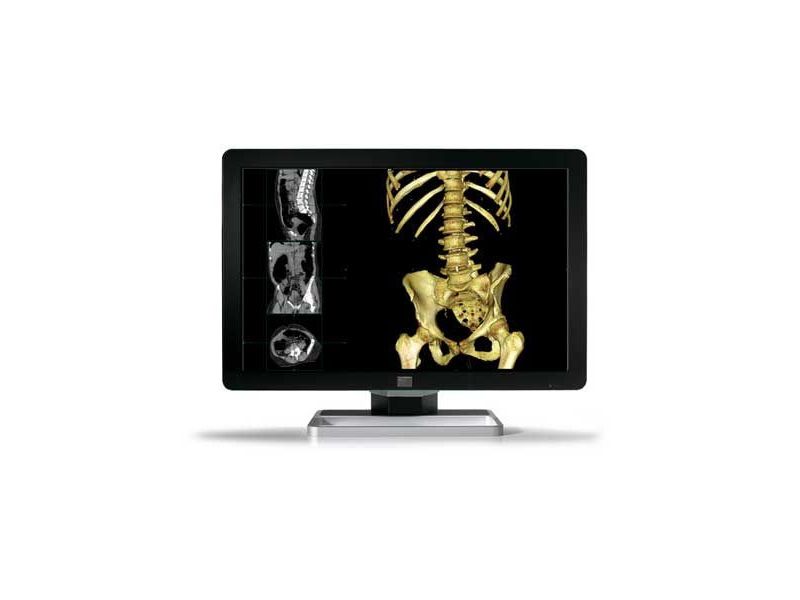Barco Coronis MDCC-6330 6MP Diagnostic Radiology Monitor