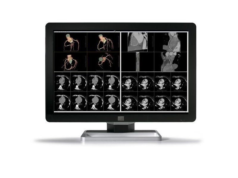 Barco Coronis MDCC-6430 6MP Diagnostic Radiology Monitor