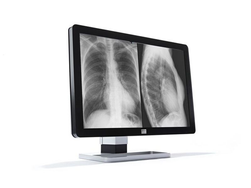 Barco MDCG-10130 10MP Diagnostic Radiology Monitor