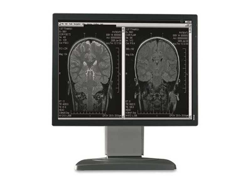 Barco Coronis MDCG-2121 2MP Diagnostic Radiology Monitor