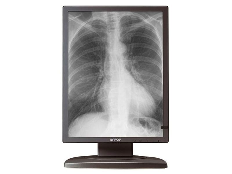Barco MDCG-3120 3MP Diagnostic Radiology Monitor