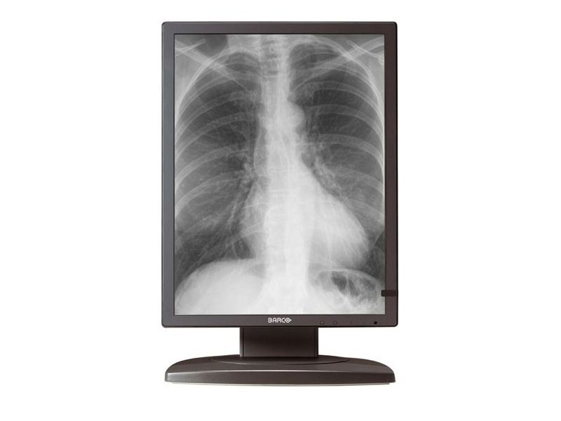 Barco Coronis MDCG-3121 3MP Diagnostic Radiology Monitor