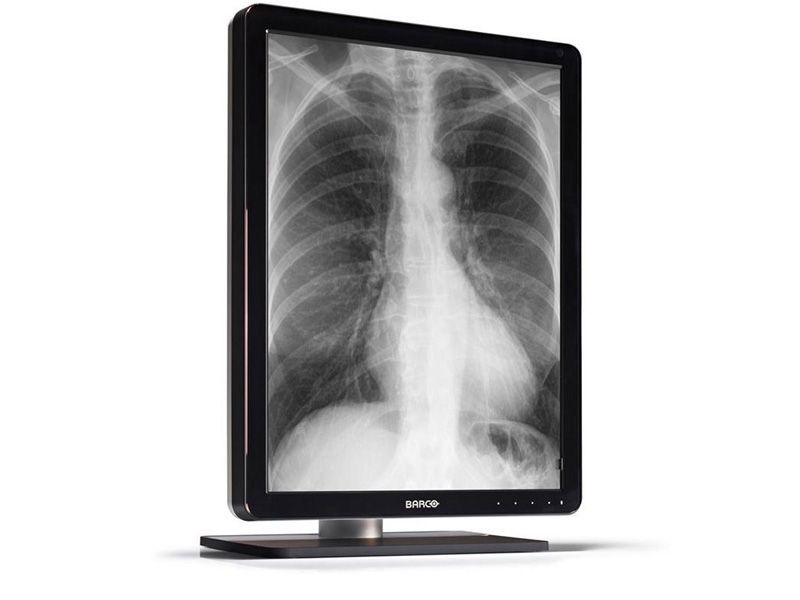 Barco Coronis MDCG-3221 3MP Diagnostic Radiology Monitor