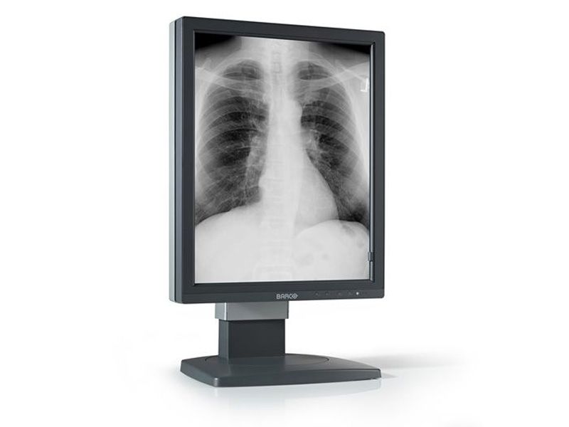 Barco MDCG-5121 5MP Diagnostic Radiology Monitor