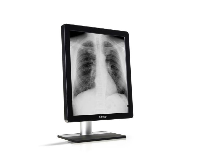Barco MDCG-5221 5MP Diagnostic Radiology Monitor