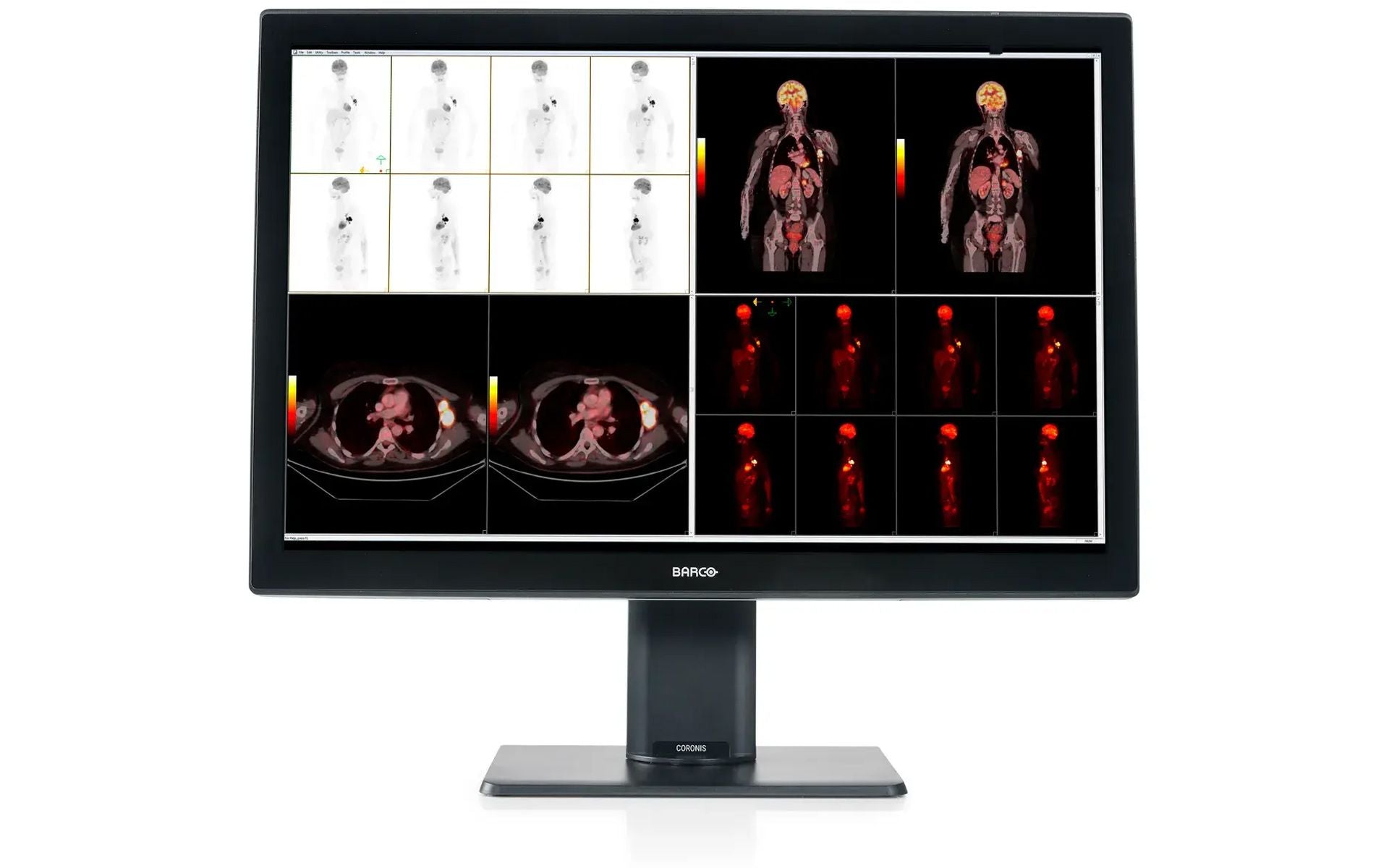 Barco MDCC-6530 6MP Radiology Monitor