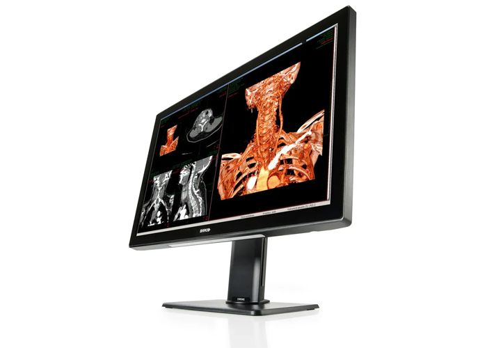 Barco MDCC-6530 6MP Radiology Monitor