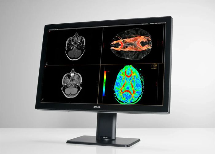 Barco MDCC-6530 6MP Radiology Monitor