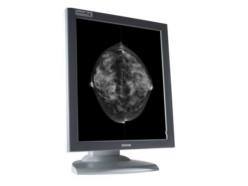 Barco MDMG-5121 5MP Diagnostic Radiology Monitor