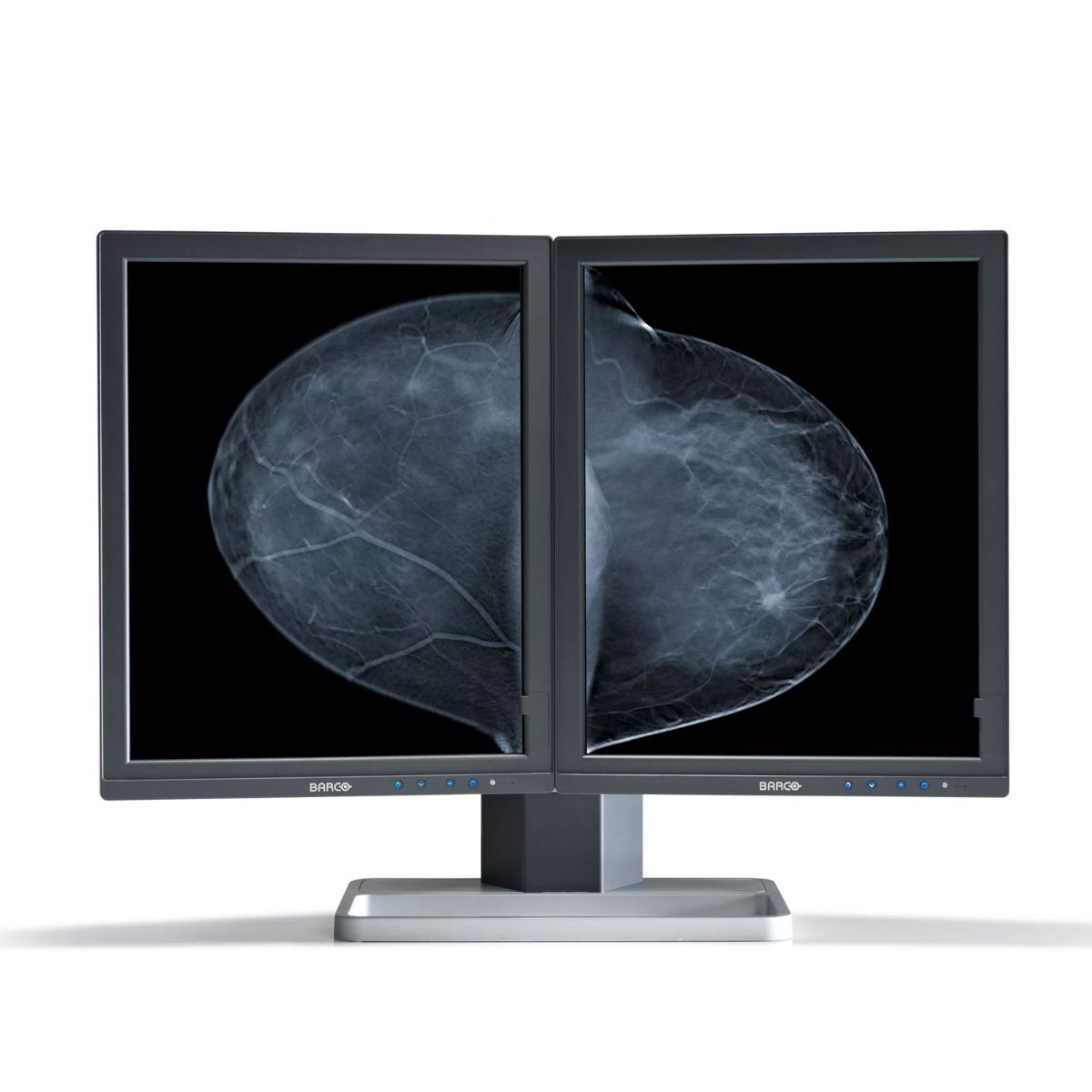 Barco MDMG-5221 5MP Tomosynthesis Monitor - Repair