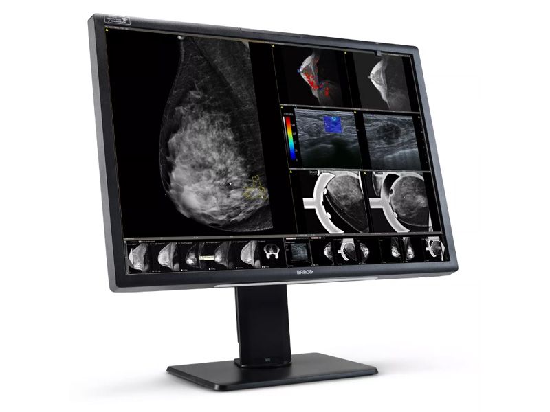 Barco MDNC-12130 Nio Fusion 12MP Radiology Monitor