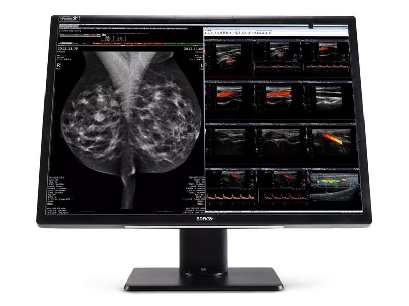 Barco MDNC-12130 Nio Fusion 12MP Radiology Monitor