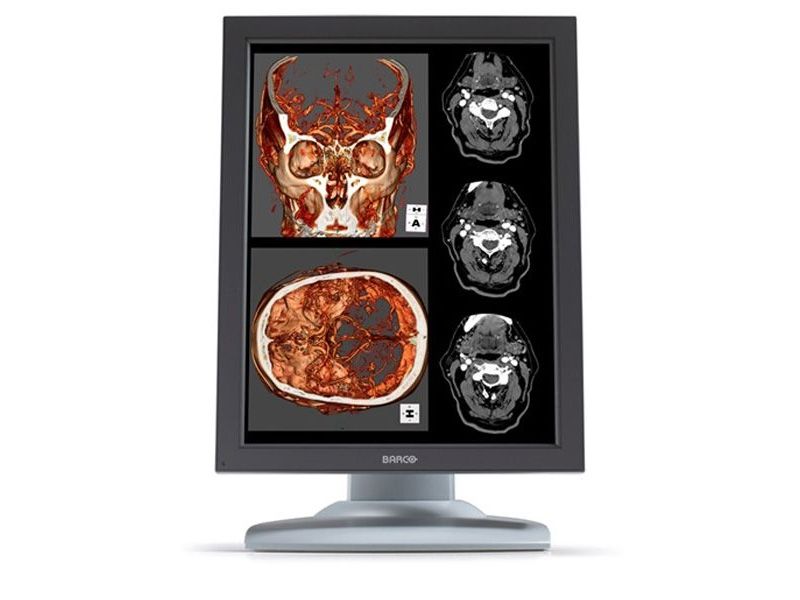 Barco Nio MDNC-2121 2MP Diagnostic Radiology Monitor