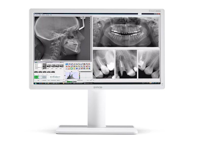 Barco MDNC-2123 2MP Diagnostic Display Monitor