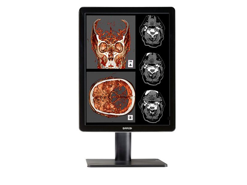 Barco MDNC-2221 2MP Diagnostic Radiology Monitor