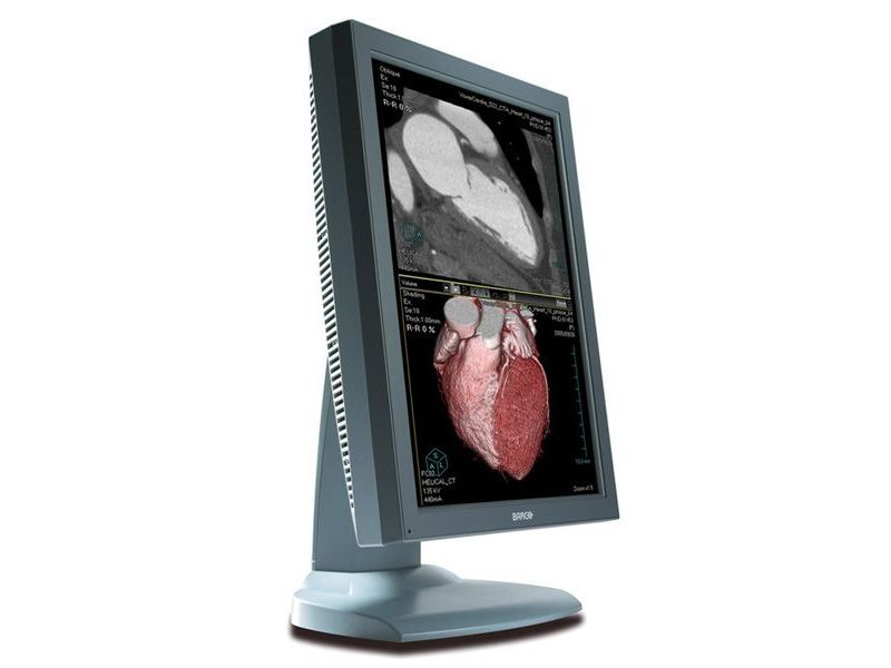 Barco Nio MDNC-3121 3MP Diagnostic Radiology Monitor
