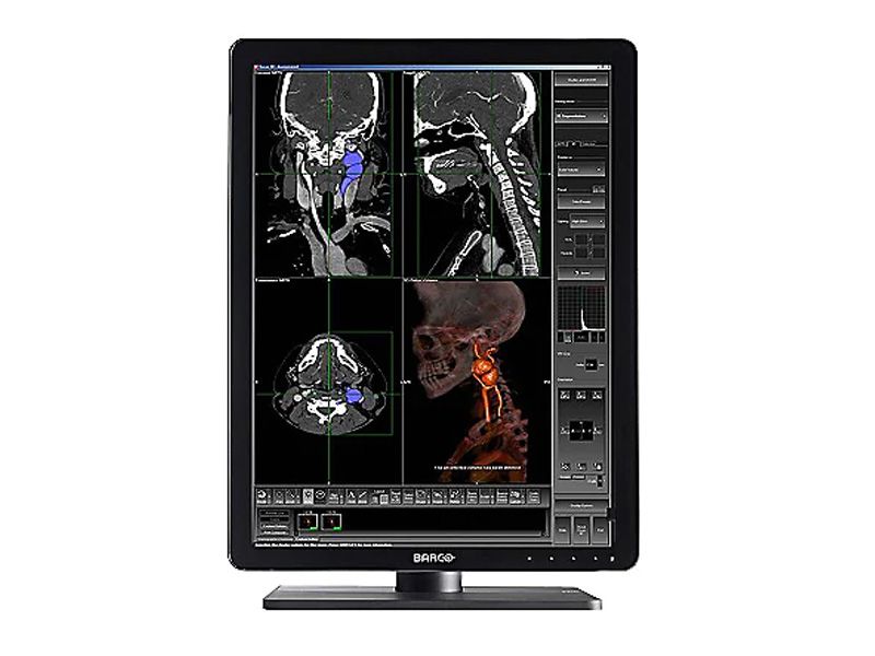 Barco Nio MDNC-3421 3MP Diagnostic Radiology Monitor