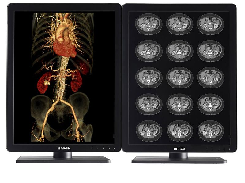 Barco Nio MDNC-3421 3MP Diagnostic Radiology Monitor