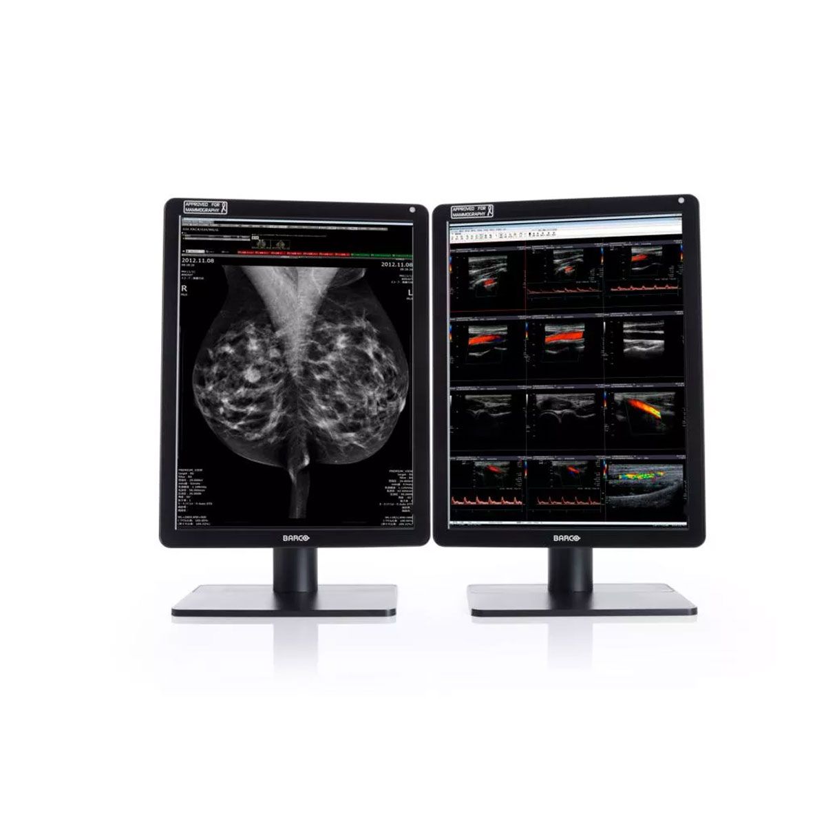 Barco MDNC-6121 5.8MP Radiology Monitor