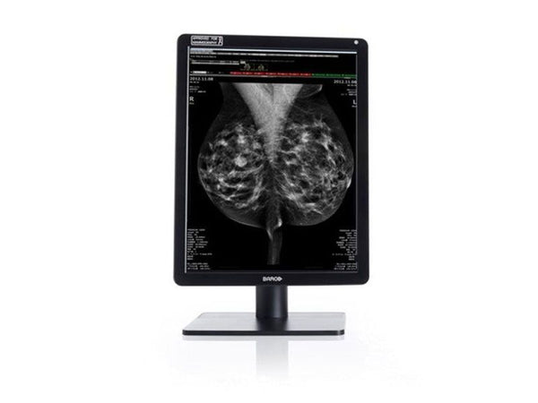 Monitor Barco Nio Color 5.8MP MDNC-6121