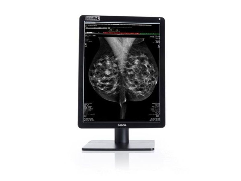 Barco MDNC-6121 5.8MP Radiology Monitor