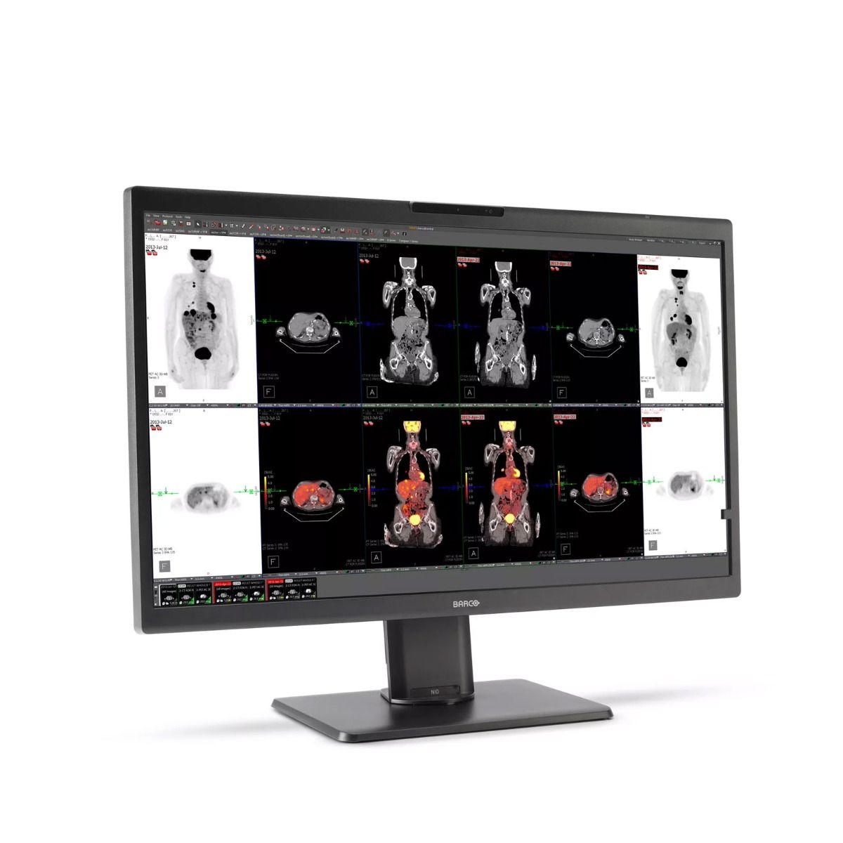 Barco MDNC-8132 8MP Radiology Diagnostic Monitor