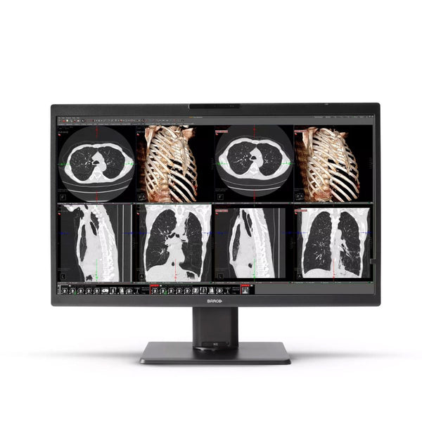 Monitor Barco Nio Color 8MP MDNC-8132