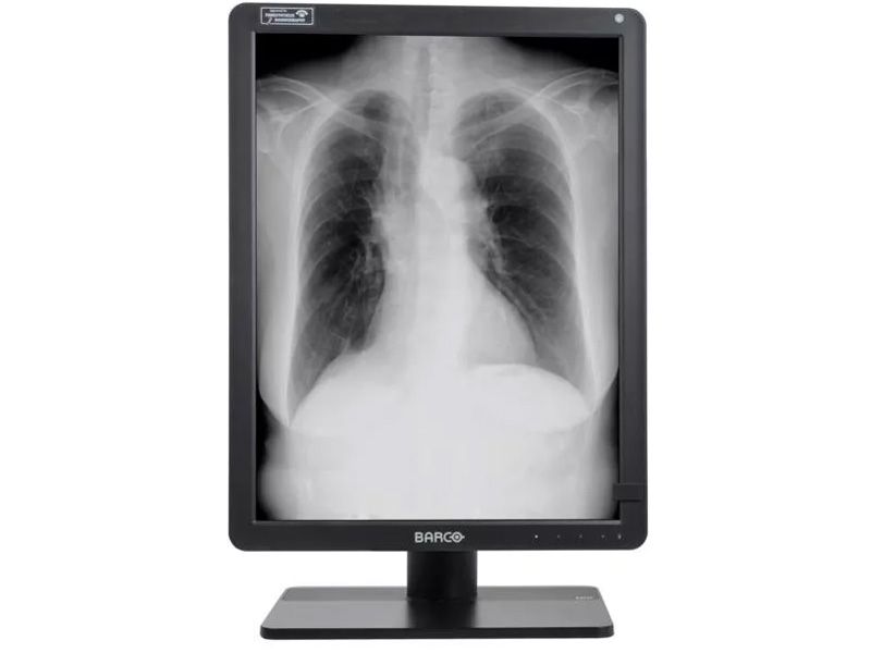 Barco MDNG-6221 5.8MP Diagnostic Radiology Monitor