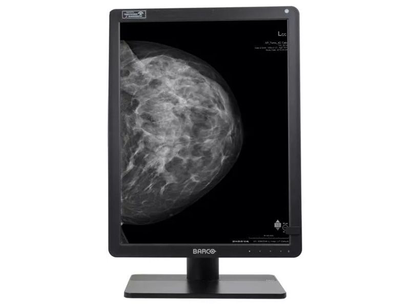 Barco MDNG-6221 5.8MP Diagnostic Radiology Monitor